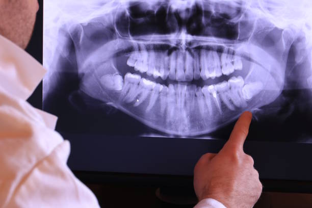 Best Pediatric Emergency Dentist in Hilton, NY